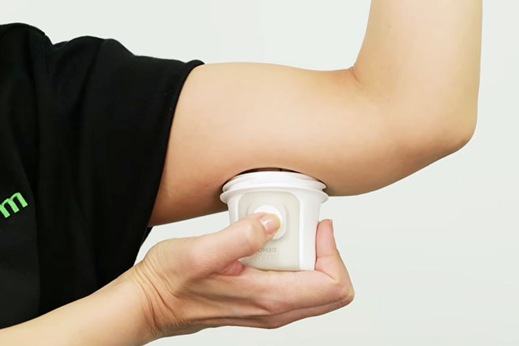 持続血糖測定（CGM）「Dexcom G7」の写真