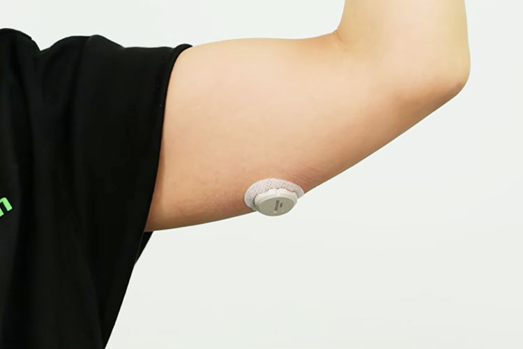 持続血糖測定（CGM）「Dexcom G7」の写真