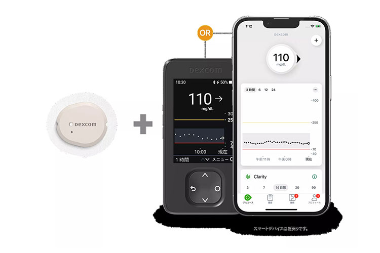 CGM（シージーエム）の説明図